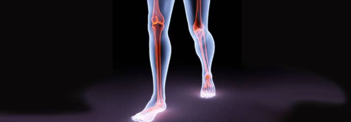 What running sport rarely gets hamstring injuries in Chalfont PA?